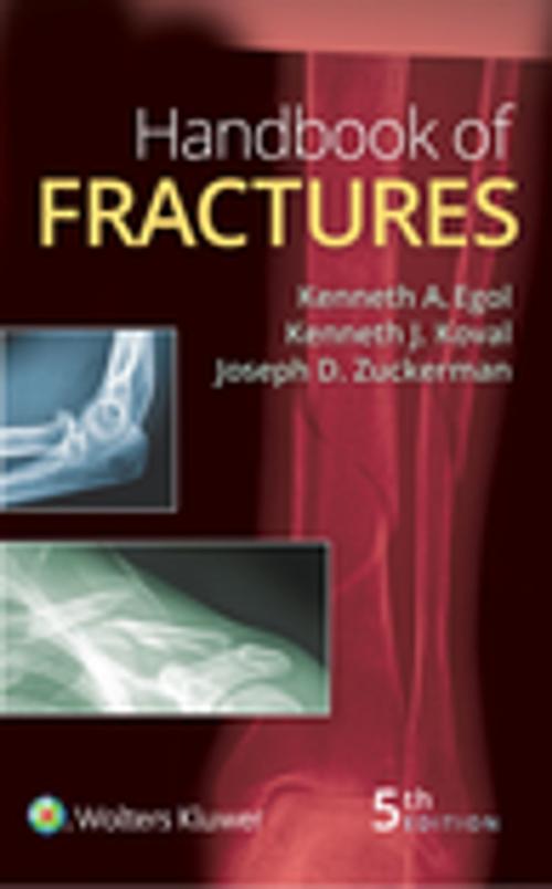 Cover of the book Handbook of Fractures by Kenneth Egol, Kenneth J. Koval, Joseph Zuckerman, Wolters Kluwer Health