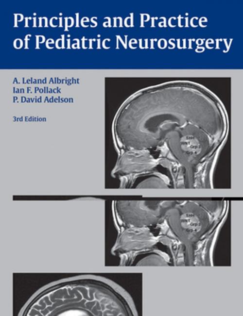 Cover of the book Principles and Practice of Pediatric Neurosurgery by A. Leland Albright, Ian F. Pollack, P. David Adelson, Thieme