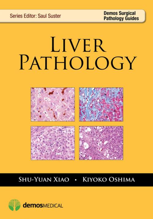 Cover of the book Liver Pathology by Kiyoko Oshima, MD, Shu-Yuan Xiao, Springer Publishing Company