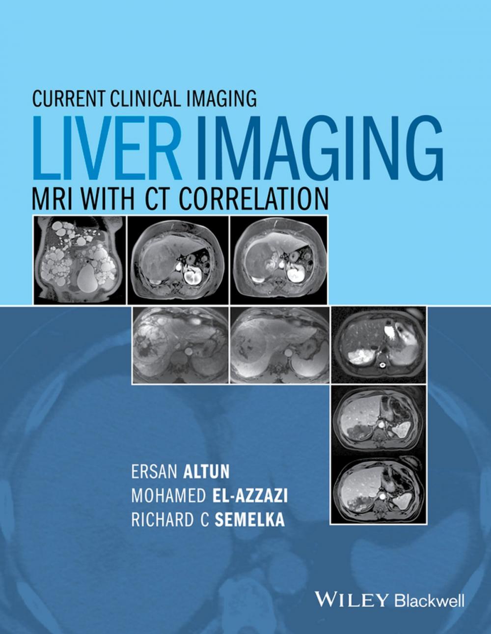 Big bigCover of Liver Imaging