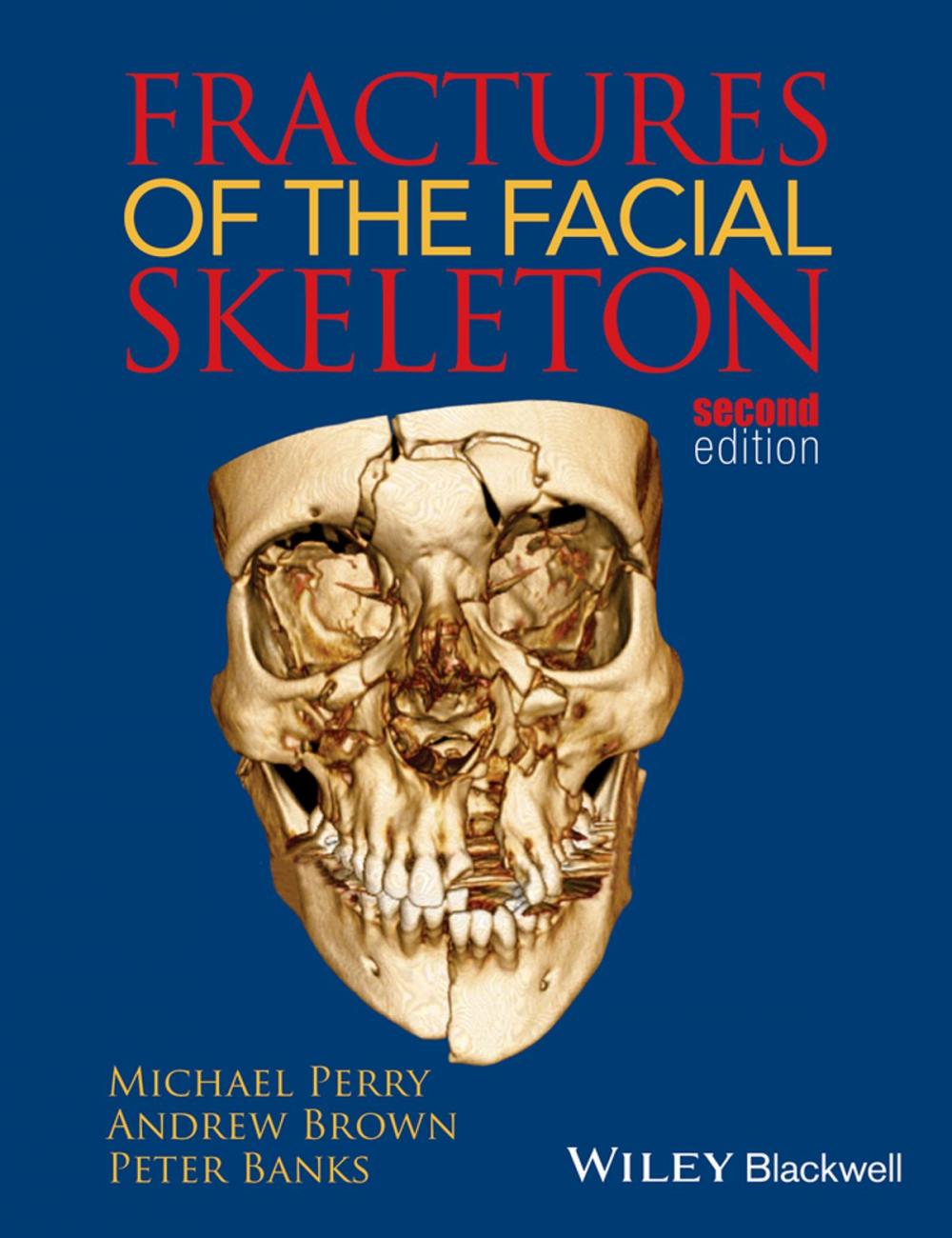 Big bigCover of Fractures of the Facial Skeleton