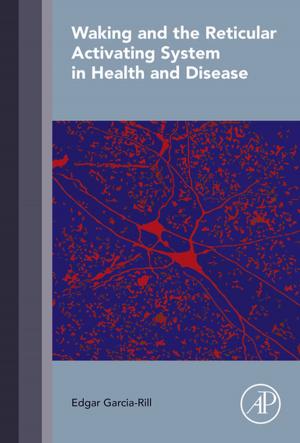 Cover of the book Waking and the Reticular Activating System in Health and Disease by Allison Druin