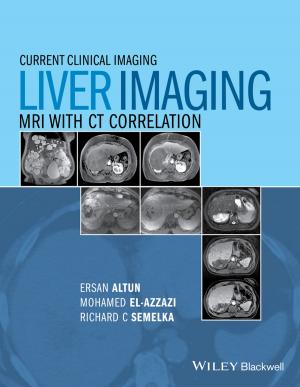 Cover of the book Liver Imaging by Bud E. Smith