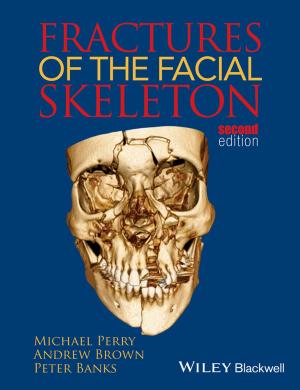 Book cover of Fractures of the Facial Skeleton