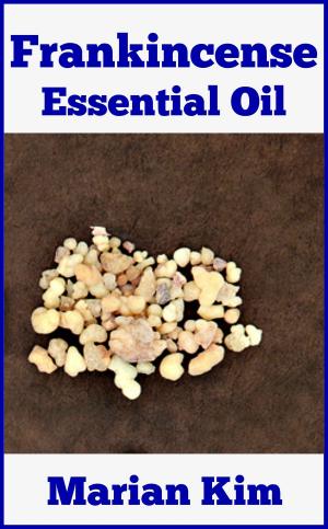 bigCover of the book Frankincense Essential Oil by 