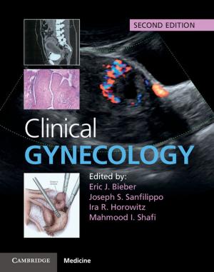 Cover of the book Clinical Gynecology by Seymour Drescher