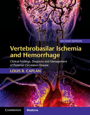 Book cover of Vertebrobasilar Ischemia and Hemorrhage
