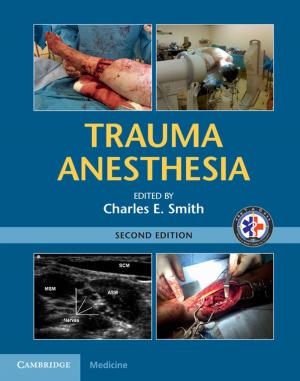 Cover of the book Trauma Anesthesia by Professor Charles C. Camosy