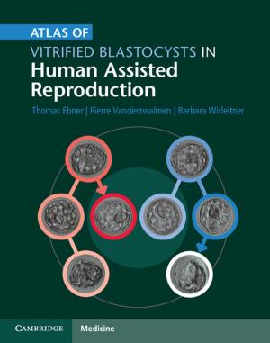 Cover of the book Atlas of Vitrified Blastocysts in Human Assisted Reproduction by Daniel R. Lynch, David A. Greenberg, Ata Bilgili, Dennis J. McGillicuddy, Jr, James P. Manning, Alfredo L. Aretxabaleta