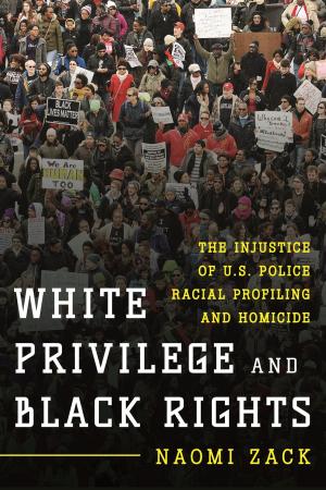 Cover of the book White Privilege and Black Rights by Rudy J. Favretti, Joy Putman Favretti