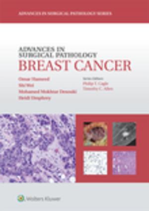 Cover of the book Advances in Surgical Pathology: Breast Cancer by Lippincott Williams & Wilkins