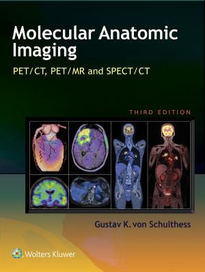 Cover of Molecular Anatomic Imaging