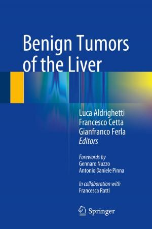 Cover of the book Benign Tumors of the Liver by Nikolay K. Vitanov