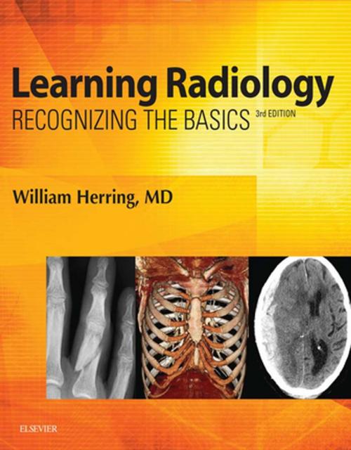 Cover of the book Learning Radiology E-Book by William Herring, MD, FACR, Elsevier Health Sciences