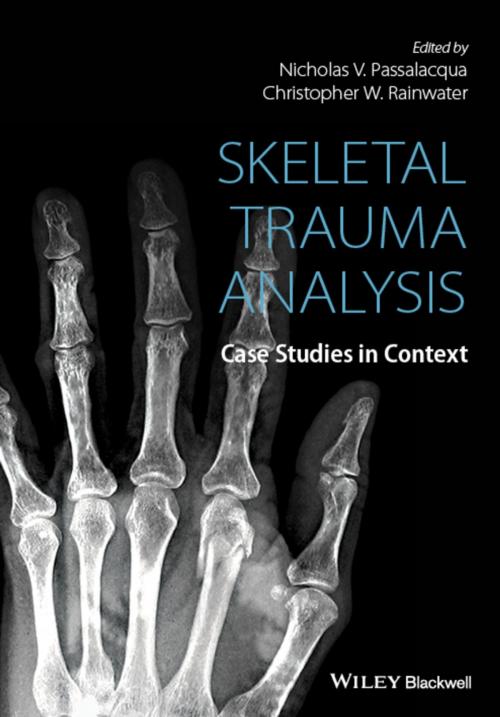Cover of the book Skeletal Trauma Analysis by , Wiley