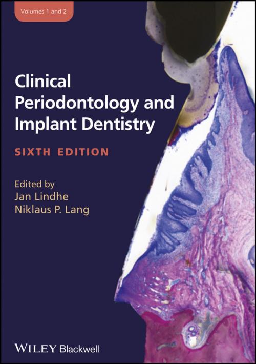 Cover of the book Clinical Periodontology and Implant Dentistry, 2 Volume Set by , Wiley
