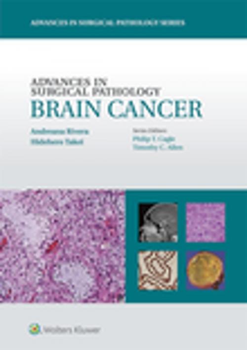 Cover of the book Advances in Surgical Pathology: Brain Cancer by Andreana Rivera, Hidehiro Takei, Wolters Kluwer Health
