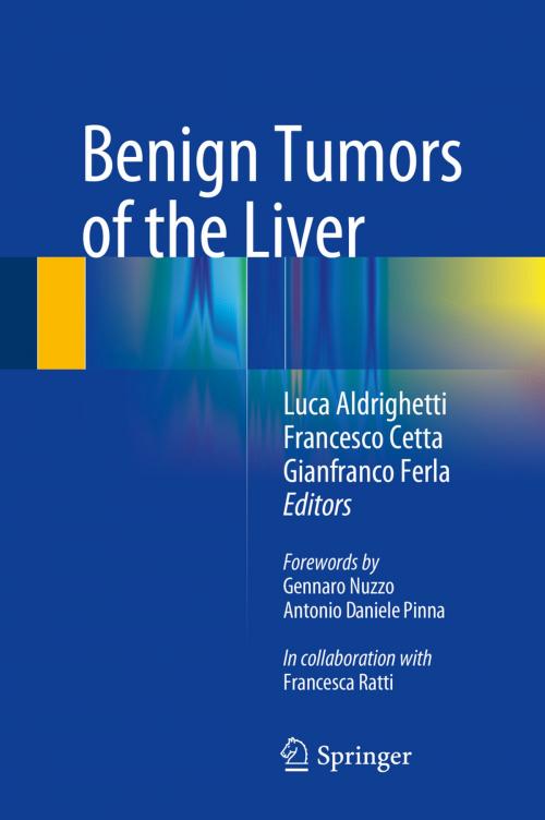 Cover of the book Benign Tumors of the Liver by , Springer International Publishing