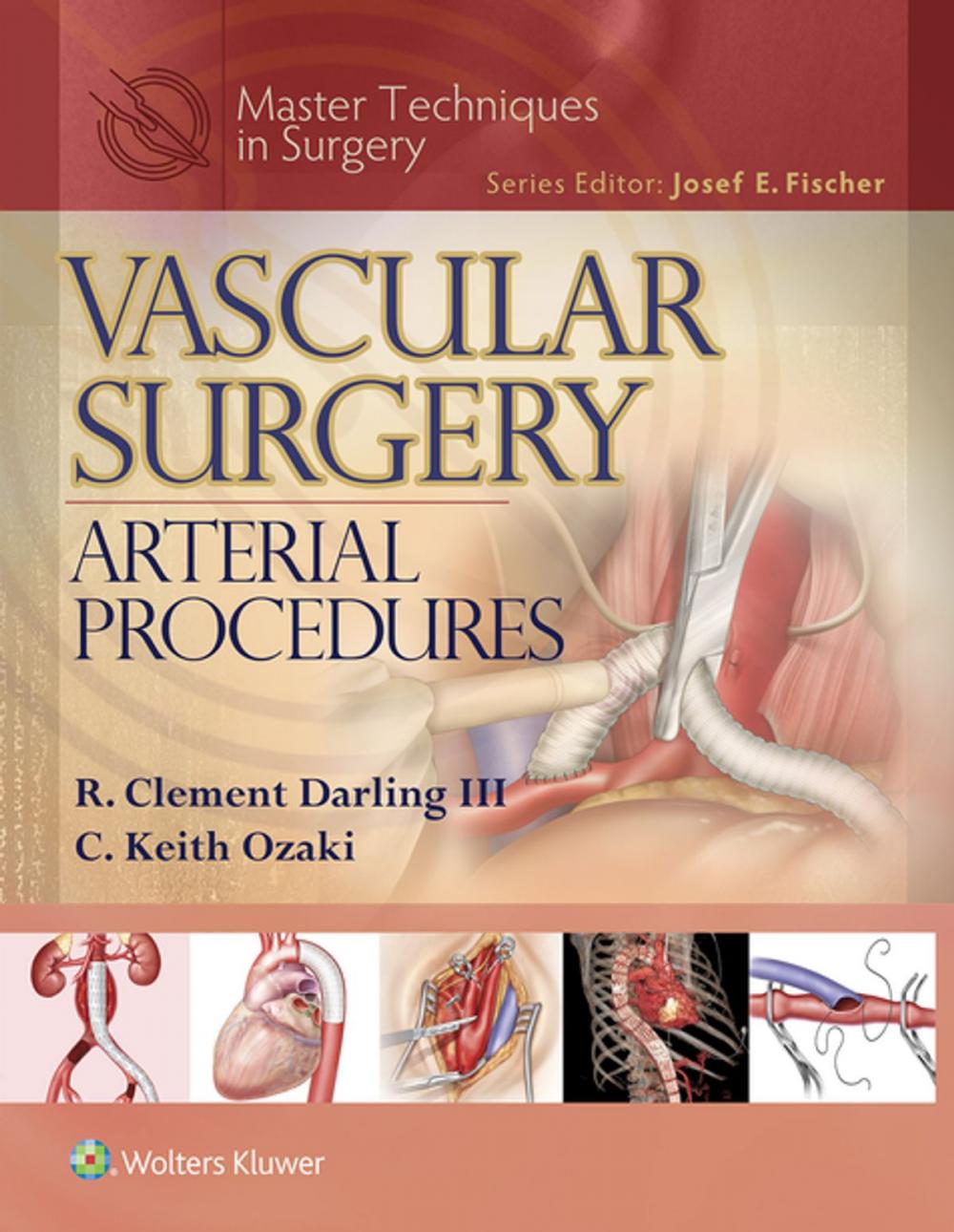 Big bigCover of Master Techniques in Surgery: Vascular Surgery: Arterial Procedures