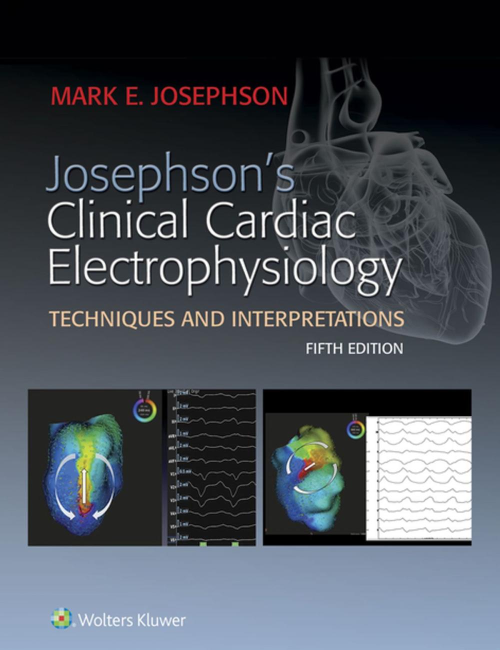 Big bigCover of Josephson's Clinical Cardiac Electrophysiology