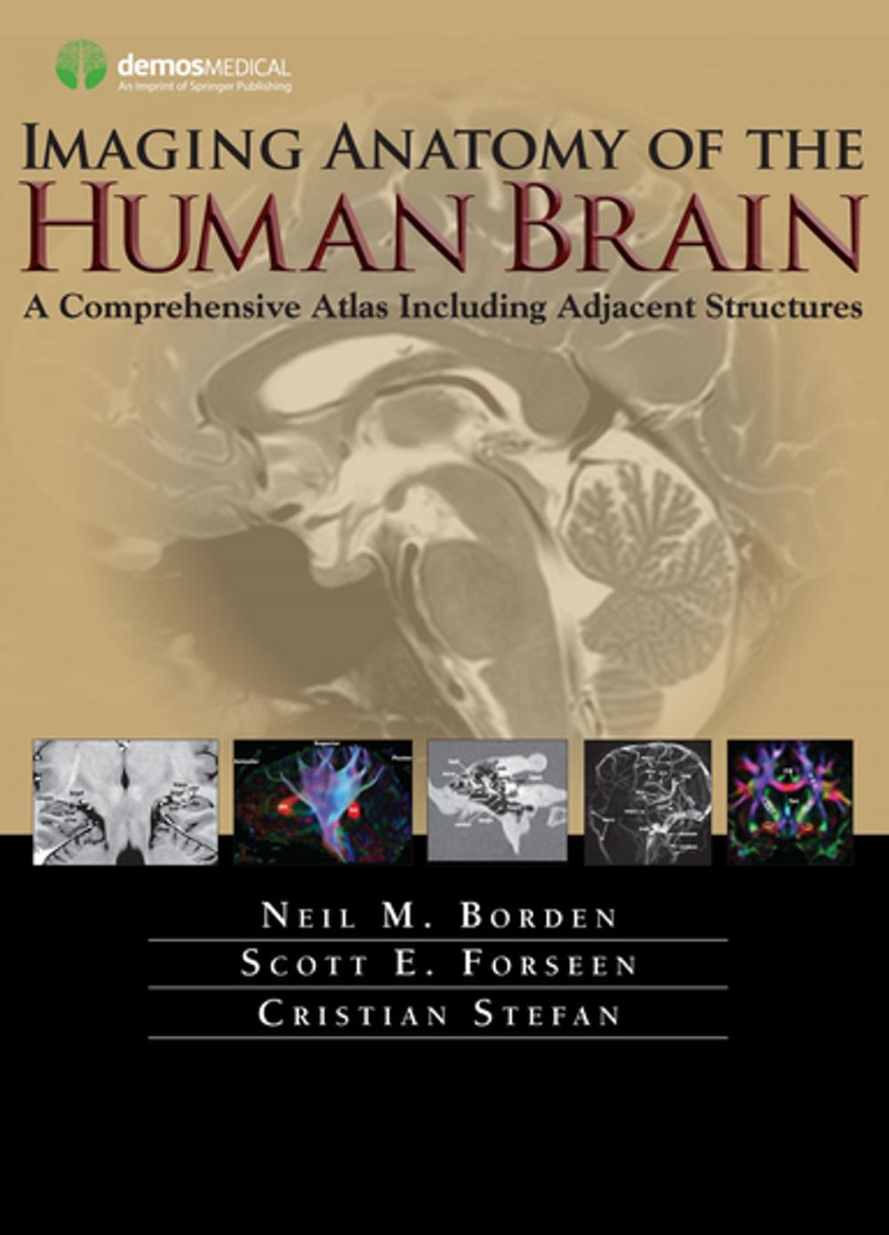 Big bigCover of Imaging Anatomy of the Human Brain