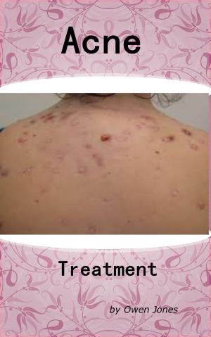 Book cover of Acne Treatment