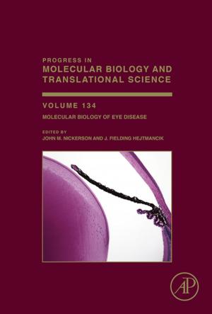 Cover of the book Molecular Biology of Eye Disease by Claire Soares, EMM Systems, Dallas, Texas, USAPrincipal Engineer (P. E.)