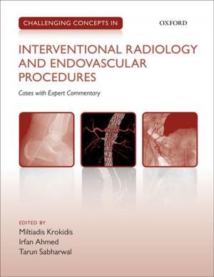 Cover of the book Challenging Concepts in Interventional Radiology by John Oberdiek