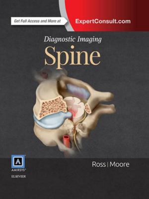 Cover of the book Diagnostic Imaging: Spine E-Book by Adrianne Dill Linton, PhD, RN, FAAN