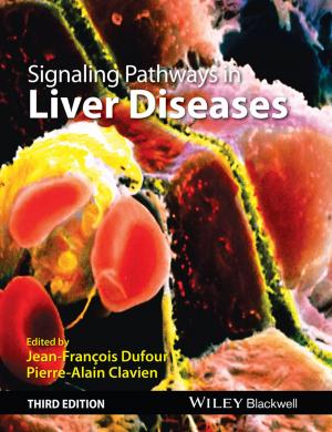 Cover of the book Signaling Pathways in Liver Diseases by Buddy Hobart, Herb Sendek
