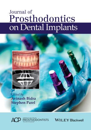 Cover of the book Journal of Prosthodontics on Dental Implants by Keith Oldham, Jan Myland, Alan Bond