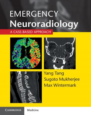 Cover of the book Emergency Neuroradiology by Andy Wood