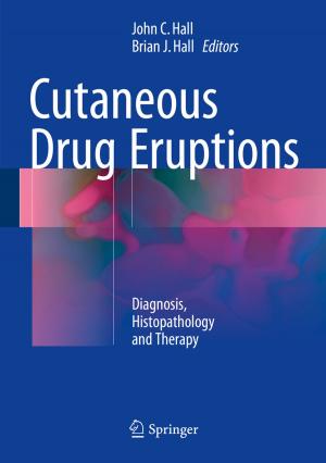 Cover of the book Cutaneous Drug Eruptions by Alejandro Héctor Toselli, Enrique Vidal, Francisco Casacuberta