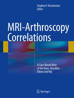Cover of the book MRI-Arthroscopy Correlations by Peter J. Brockwell, Richard A. Davis