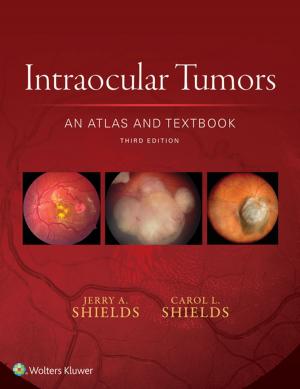 Cover of the book Intraocular Tumors: An Atlas and Textbook by Melanie Goldfarb, Mark A. Gromski, James M. Hurst, Daniel B. Jones