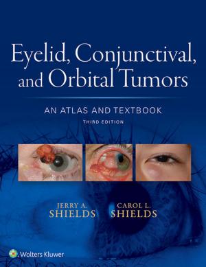 Book cover of Eyelid, Conjunctival, and Orbital Tumors: An Atlas and Textbook