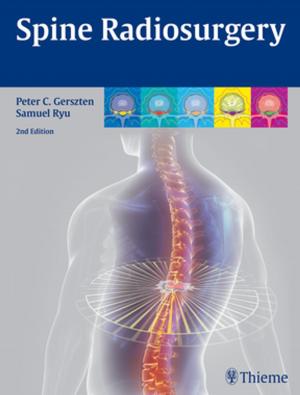 Cover of the book Spine Radiosurgery by Jiri Dvorak, Vaclav Dvorak, Wolfgang G. Gilliar