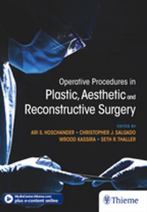 Cover of the book Operative Procedures in Plastic, Aesthetic and Reconstructive Surgery by Michael Schuenke, Erik Schulte, Udo Schumacher