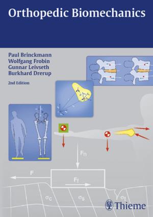 Cover of the book Orthopedic Biomechanics by Claus C. Schnorrenberger, Beate Schnorrenberger