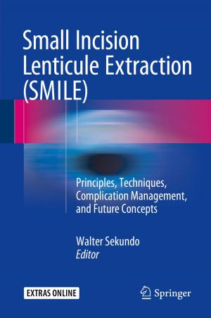 Cover of the book Small Incision Lenticule Extraction (SMILE) by Giuseppe Giordan, Adam Possamai