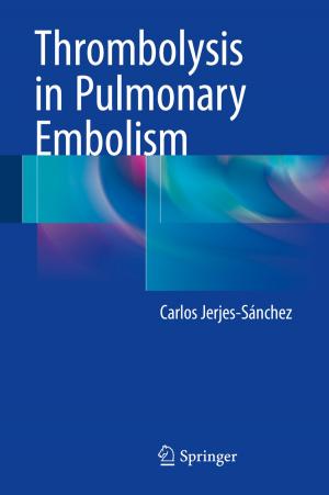 Cover of the book Thrombolysis in Pulmonary Embolism by Miroslav Kubat
