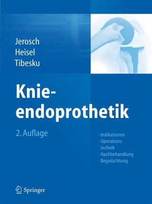 Cover of the book Knieendoprothetik by Jürgen Müller