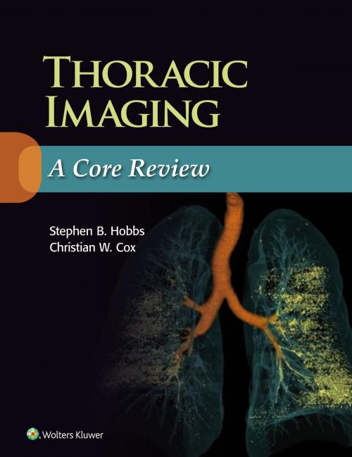 Cover of the book Thoracic Imaging: A Core Review by Stephen Hobbs, Christian Cox, Wolters Kluwer Health