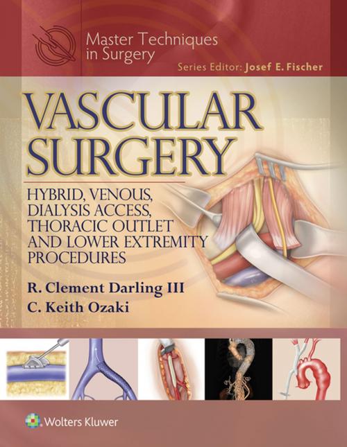 Cover of the book Master Techniques in Surgery: Vascular Surgery: Hybrid, Venous, Dialysis Access, Thoracic Outlet, and Lower Extremity Procedures by R. Clement Darling, C. Keith Ozaki, Wolters Kluwer Health