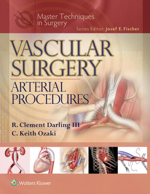 Cover of the book Master Techniques in Surgery: Vascular Surgery: Arterial Procedures by R. Clement Darling, C. Keith Ozaki, Wolters Kluwer Health