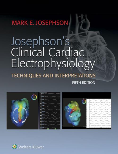 Cover of the book Josephson's Clinical Cardiac Electrophysiology by Mark E. Josephson, Wolters Kluwer Health