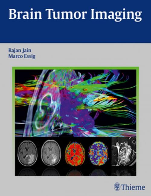 Cover of the book Brain Tumor Imaging by Rajan Jain, Marco Essig, Thieme
