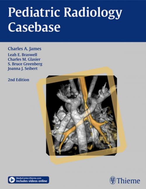 Cover of the book Pediatric Radiology Casebase by Charles James, Charles M. Glasier, Bruce S. Greenberg, Thieme