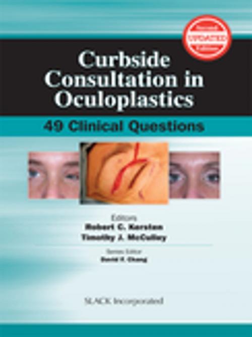 Cover of the book Curbside Consultation in Oculoplastics by , SLACK Incorporated