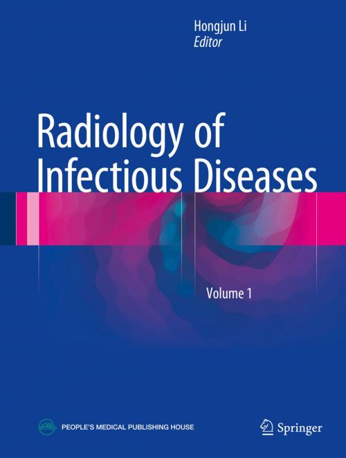 Cover of the book Radiology of Infectious Diseases: Volume 1 by , Springer Netherlands